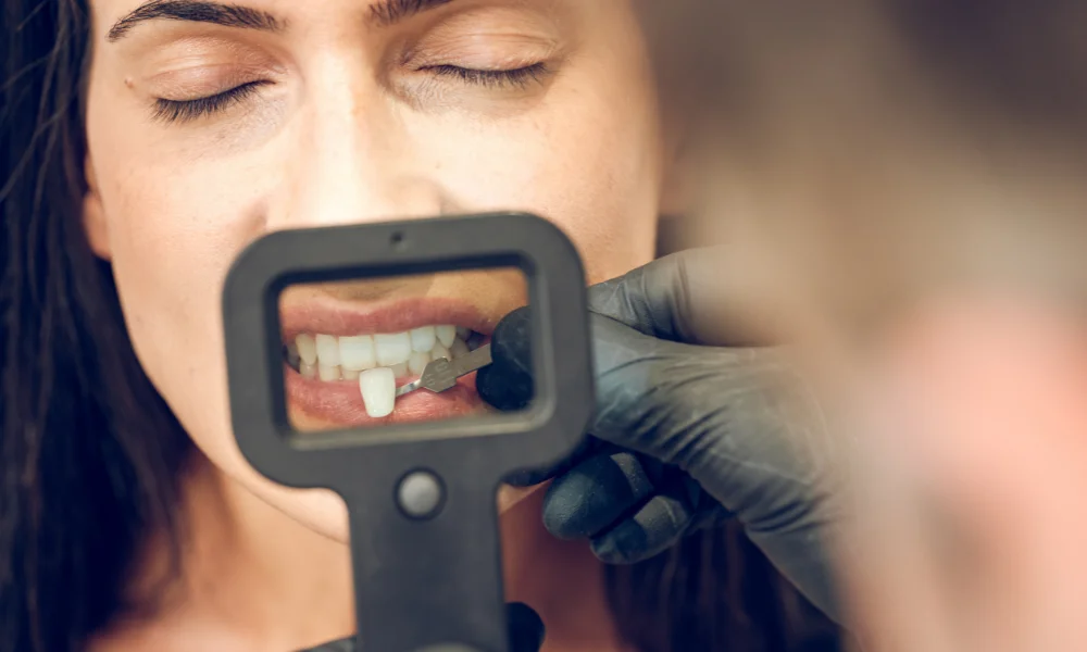 A Guide to Cosmetic Teeth Procedures for Pets and Their Benefits 